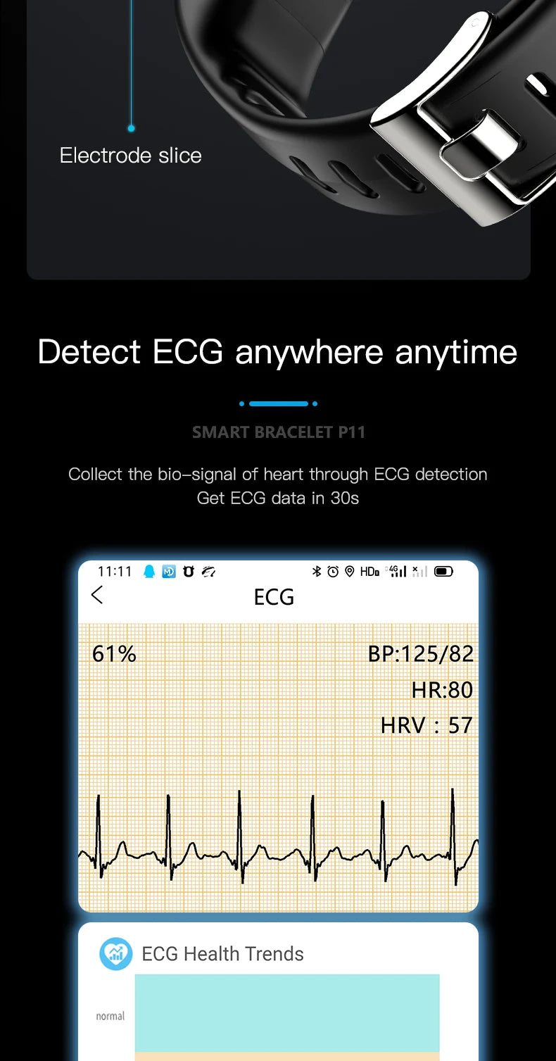 EKG PPG Spo2 Smart Bracelet Watch Medical Health ECC Fitness Tracker for Men Women Calorie Blood Pressure Smartwatch